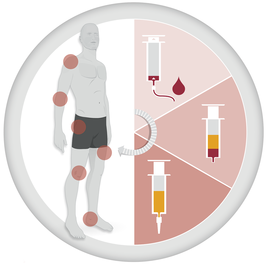 dam-media/acp-therapy-simple