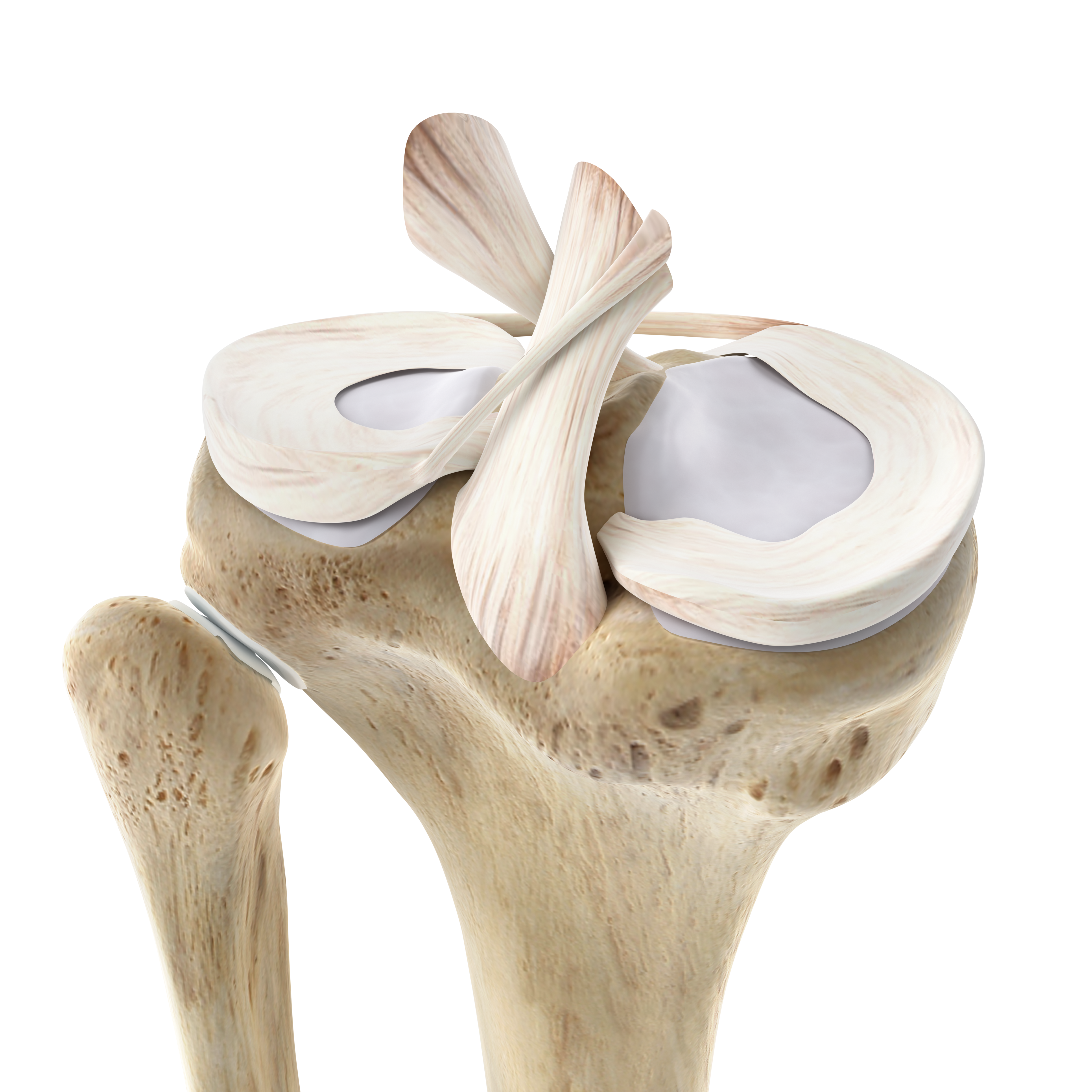 dam-media/arthrex-joint-knee-tibia-l-c-meniscus-cruciate-cam-t-0003_tif